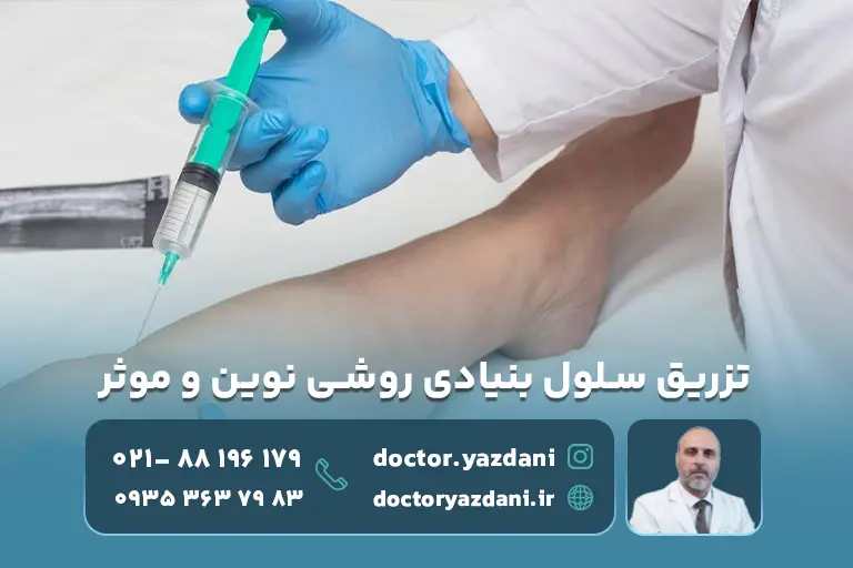 تزریق سلول بنیادی و دلایل اثربخشی آن